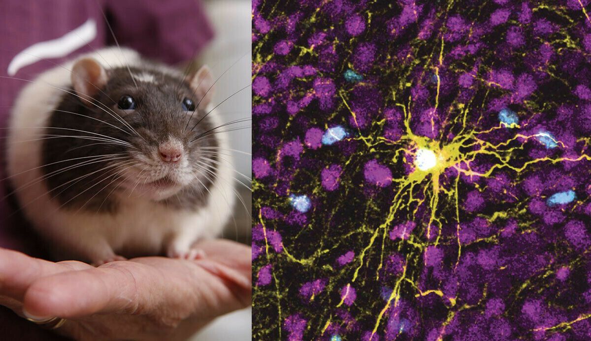 Beynin gelişimi incelenecek! Fare beynine insan beyin hücreleri yerleştirildi
