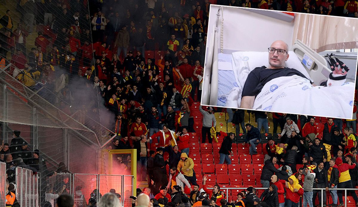 Göztepe-Altay maçında işaret fişeğiyle yaralanan taraftar konuştu: Yüzüme doğru bir şey geldiğini hissettim ama sonrası