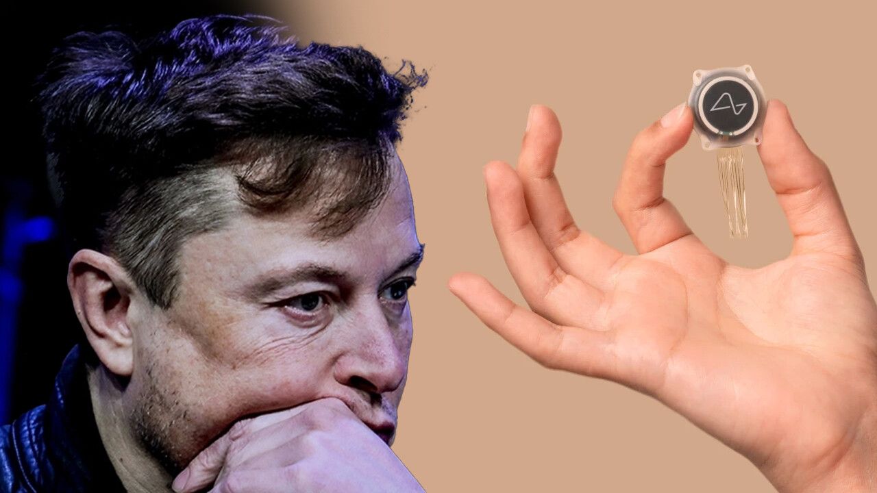 Elon Musk, insan beynine ilk defa çip yerleştirildiğini duyurdu...