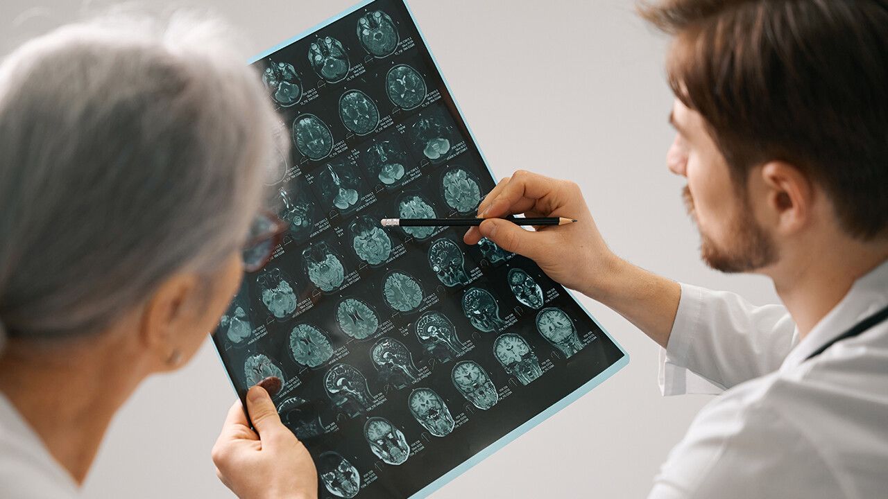 Alzheimer’ın insandan insana bulaştığına dair ilk kanıt bulundu