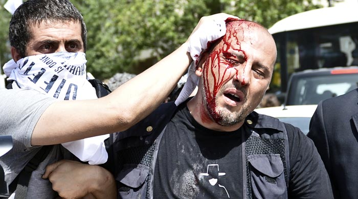 Gezi Parkı&#039;nda Ahmet Şık da yaralandı