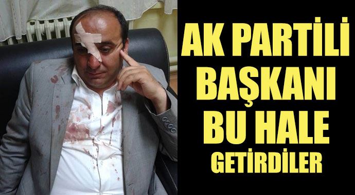 AK Partili başkanı döve döve hastanelik ettiler