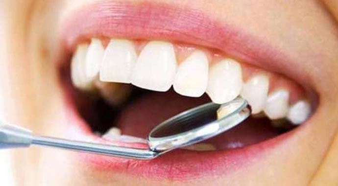  Sararmış veya grileşmiş dişlerden kurtulmak mümkün