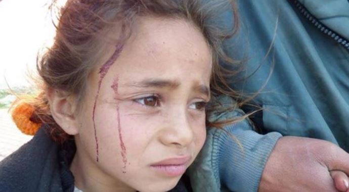 Siyonist yerleşimciler 6 yaşındaki Filistinli çocuğu yaraladı!