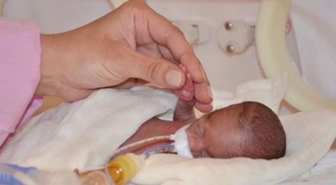 380 gramlık bebeğe ilk dokunuş