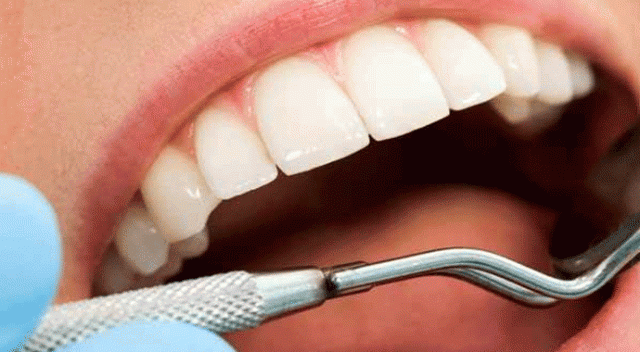 Diş çürümelerini önlemek bu kadar basit