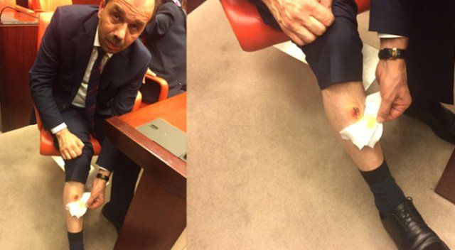 Savcılık, bacağından ısırılan AK Partili vekilin şikayetiyle soruşturma başlattı