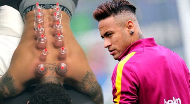 Barcelonalı Neymar, hacamat yaptırdı!