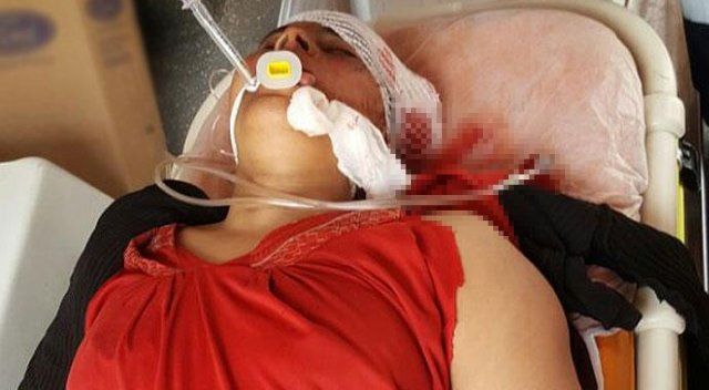 Terör örgütü PKK/PYD Suriye&#039;de sivil kadına saldırdı