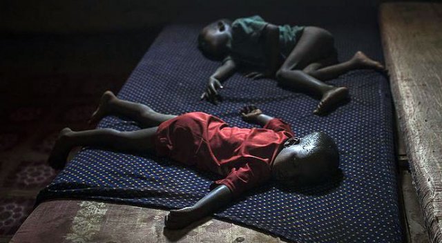 Somali&#039;de kolera 700 kişinin ölümüne neden oldu