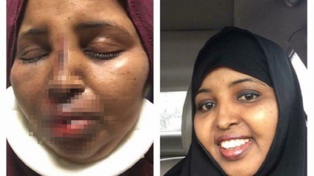 Müslüman kadına alçak saldırı
