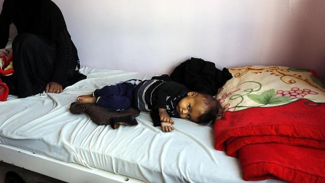Yemen&#039;deki kolera salgınının bilançosu ağırlaşıyor