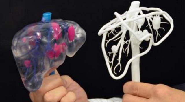 Türk bilim insanları cerrahide 3D teknolojisine imza attı
