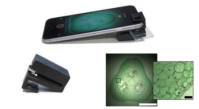 Optik eklenti cep telefonunu mikroskoba dönüştürüyor