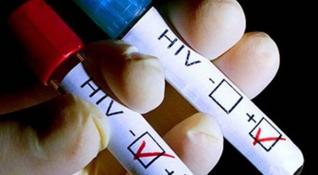Sosyal medyada HIV Pozitiflere özel site