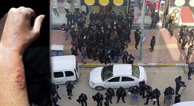 HDP&#039;li vekil polis memurunun kolunu ısırdı