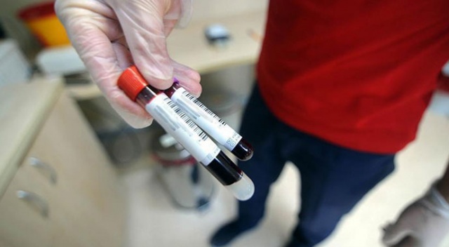Kanserle mücadelenin yeni silahı: Kan testleri