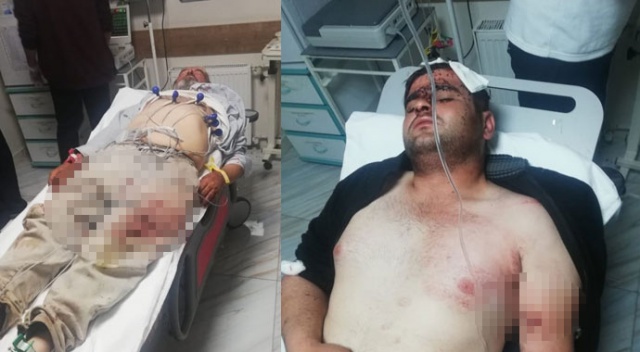 Karaman’da besicilerin mera kavgası kanlı bitti: 4 yaralı