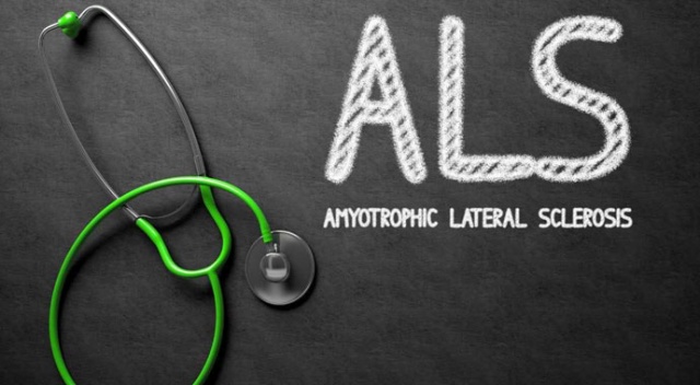ALS hastalığı erkeklerde daha sık görülüyor