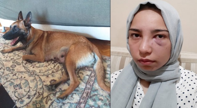Köpek kavgası... 17 yaşındaki kızı acımasızca darp ettiler