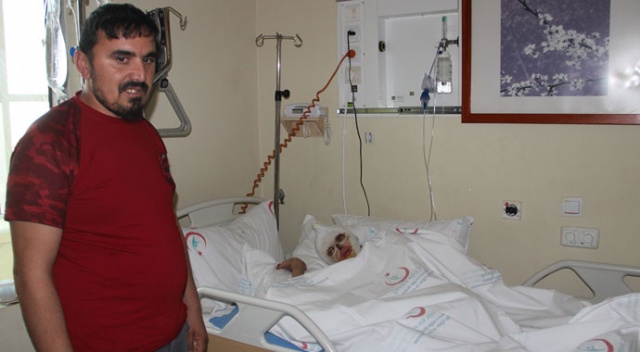 Tüp patlaması sonucu yanan kadın 2 aydır iyileşeceği günü bekliyor