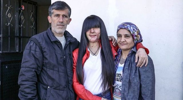 Asitli saldırı mağduru Berfin Özek ve ailesinden Erdoğan&#039;a teşekkür