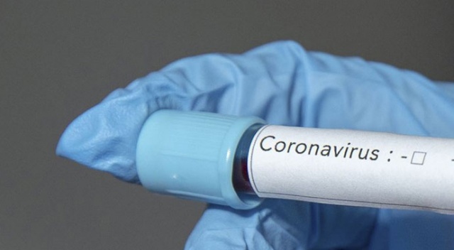 Azerbaycan’da koronavirüs vaka sayısı 3’e yükseldi