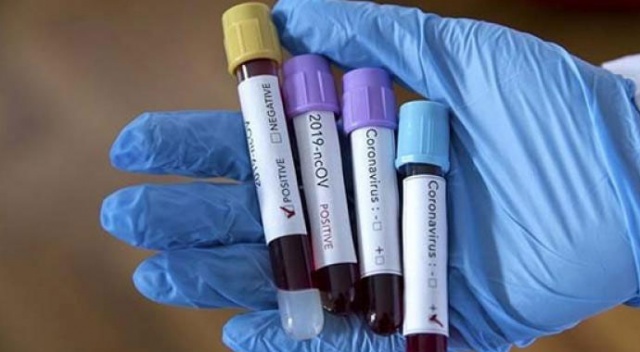 Eskişehir İl Sağlık Müdürlüğü koronavirüsü iddialarını yalanladı