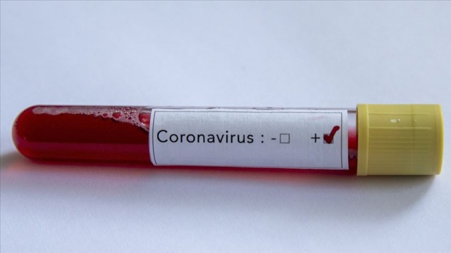 Pakistan&#039;da ilk yeni tip koronavirüs vakaları görüldü