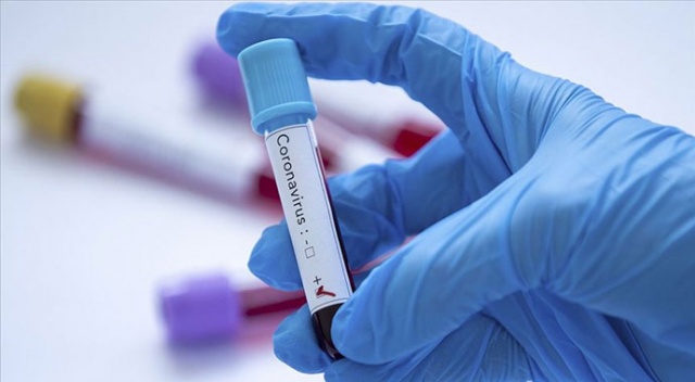 Yeni tip koronavirüsü 15 dakikada tespit eden kit geliştirildi