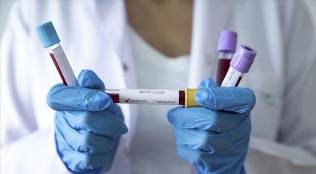 Birleşik Arap Emirlikleri&#039;nde koronavirüs vaka sayısı 153’e yükseldi