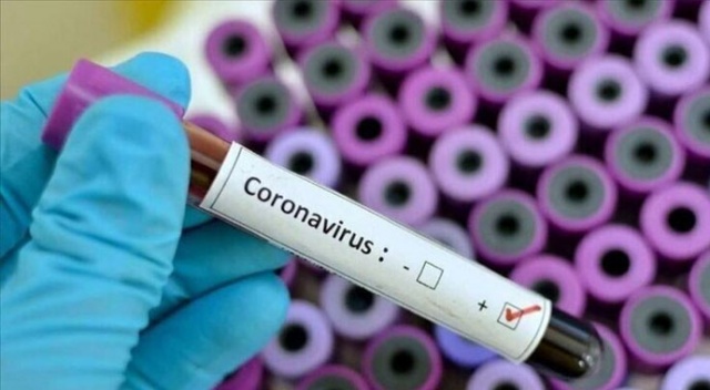 İran Savunma Bakanlığı, ürettiği koronavirüs teşhis kitini tanıttı