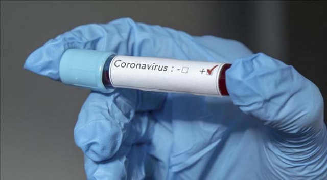 İsrail&#039;de yeni tip koronavirüs vaka sayısı 1442&#039;ye yükseldi
