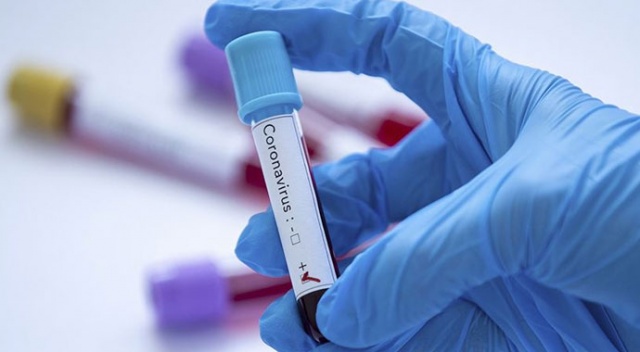 KKTC’de koronavirüs vaka sayısı 47’ye yükseldi