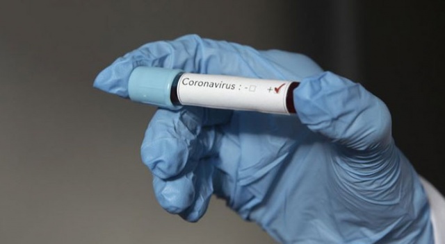 Japonya’da yeni koronavirüs ölümleri: 119&#039;a yükseldi