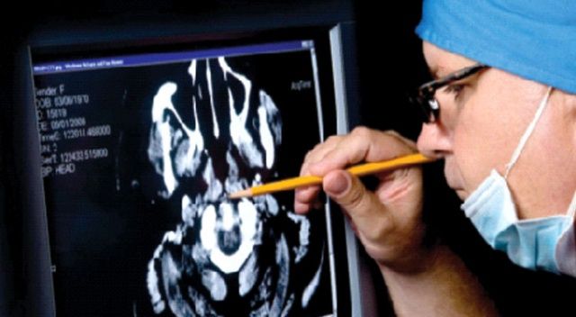 Alzheimer’a tomografi  ile teşhis