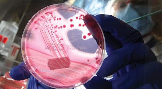 SMA Bilim Kurulu: Pandemi koşullarında gen tedavisi uygulaması uygun değil