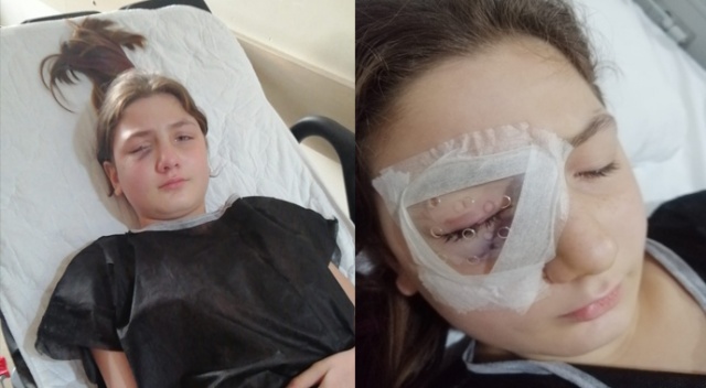 Yastık savaşı yaparken kırılan avize, 9 yaşındaki kızın gözünü parçaladı