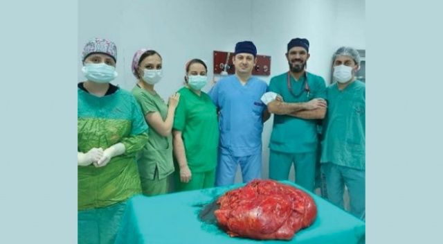 Trabzon’da ameliyata alınan hastanın karnından 21 kiloluk tümör çıkartıldı