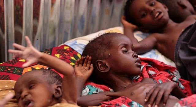 Nijerya&#039;da son 5 ayda 1158 çocuk kızamık salgınına yakalandı