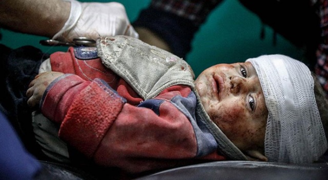 Suriye&#039;de yaralanan çocuklar Türkiye&#039;de tedavi ediliyor