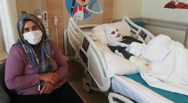 Gaz kokusunu çakmakla kontrol eden yaşlı kadın feci şekilde yandı