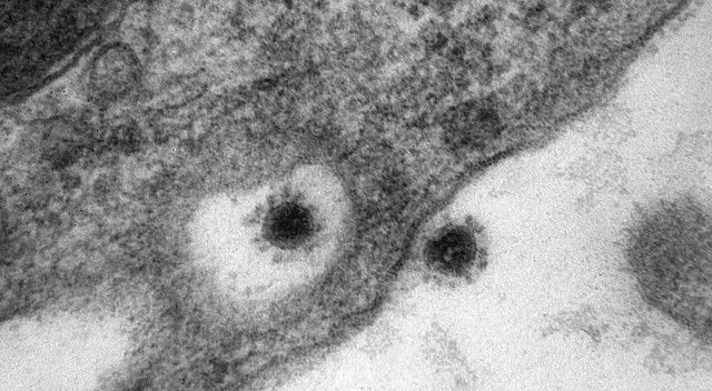 Rusya&#039;da koronavirüs Delta Plus mutasyonu mikroskopla görüntülendi