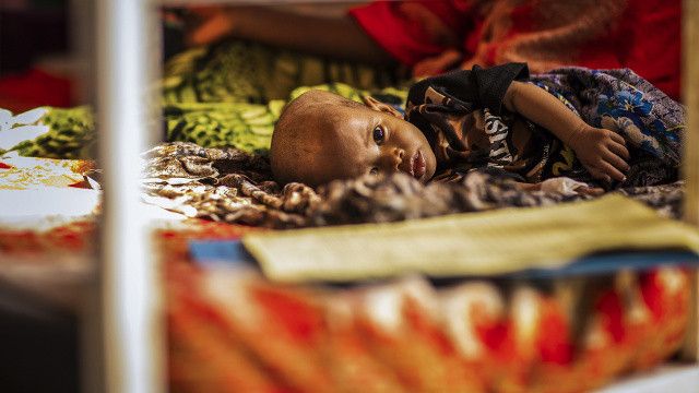 BM: Doğu Afrika&#039;da 81 milyon kişi açlıktan ölebilir