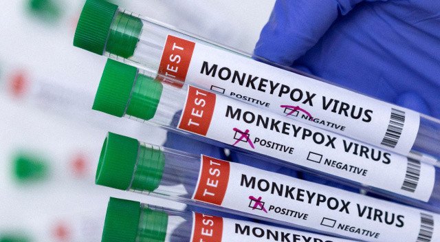 Maymun çiçeği virüsü Türkiye’de! 7 SORU 7 CEVAP: Hastalık hakkında ne biliyoruz?