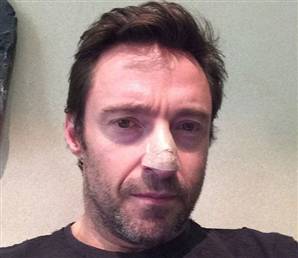 Hugh Jackman deri kanserine yakalandı