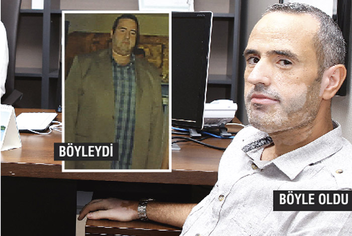 Obeziteden kurtulmanın en iyi yöntemi ameliyat