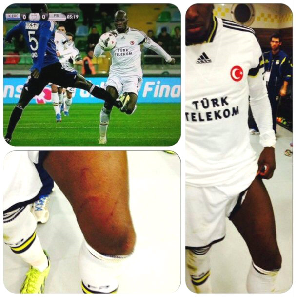 Fenerbahçe Instagram'dan bu pozisyona isyan etti