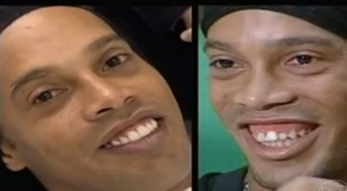 Ronaldinho ameliyat oldu, işte yeni dişleri