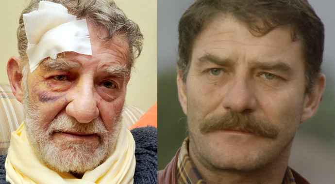 Ahmet Mekin kaza geçirdi